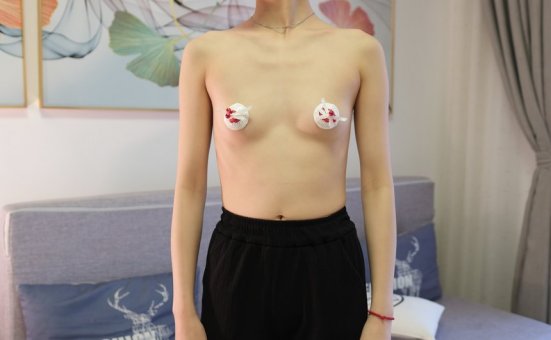 [ROSI口罩系列] 2025.05.07 No.3251 [71+1P-124M]